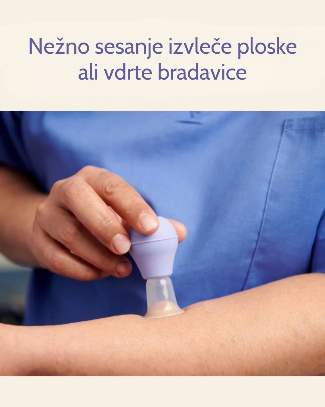 Aspirator za ploske bradavice